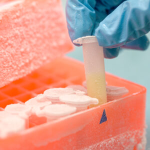 Refrigerazione e criogenizzazione